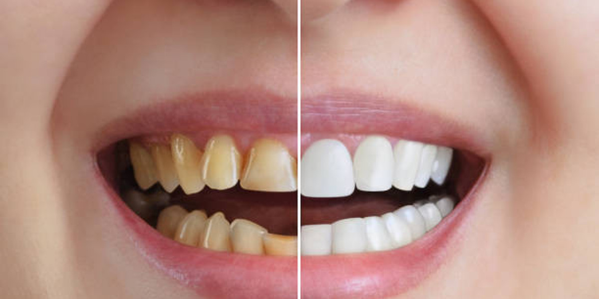 The Benefits of Visiting a Cosmetic Dentist Regularly